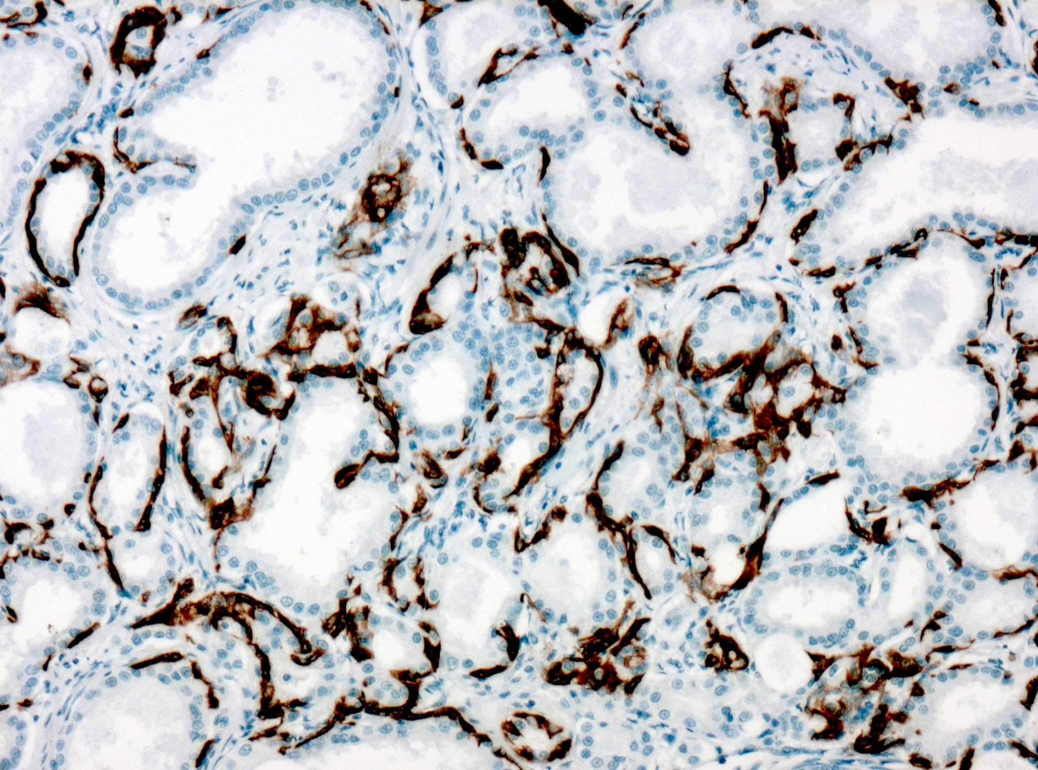 Anti-Cytokeratin 5 + Cytokeratin 14