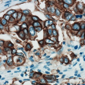 Anti-c-erbB-2  (HER-2/neu)