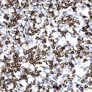 Anti-Caldesmon HMW, Smooth muscle