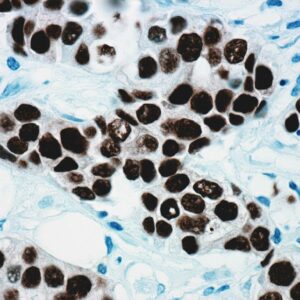 Anti-Estrogen Receptor (ER) Alpha