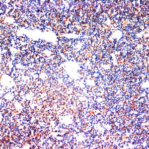 Hsa miR-101 Probe for FISH Assay