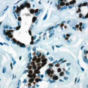 Anti-Progesterone Receptor (PR)