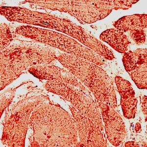 Anti-Myoglobin [Polyclonal]
