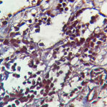 IHC on Bladder Tissue