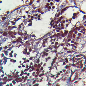 IHC on Bladder Tissue