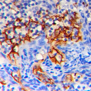 IHC on Tonsil Tissue