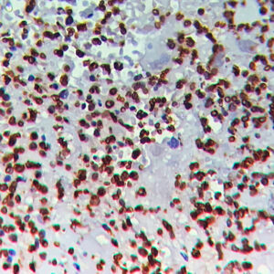IHC on Tonsil Tissue