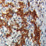 IHC on GIST Tissue