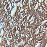 IHC on Heart Tissue