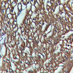 IHC on Heart Tissue
