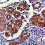 IHC on Intestine Tissue