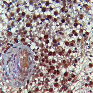 IHC on Tonsil Tissue