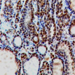 IHC on Colon Tissue