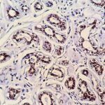 IHC on Breast Tissue