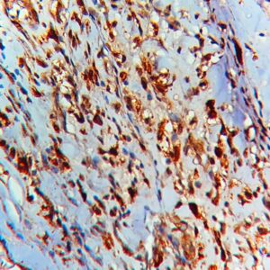 IHC on Stomach Tissue