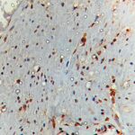 IHC on Intestine Tissue