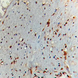 IHC on Intestine Tissue