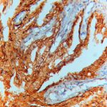 IHC on Testis Tissue