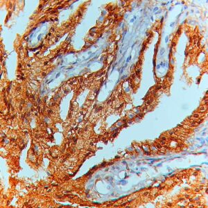 IHC on Testis Tissue
