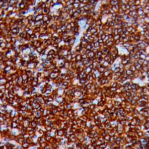 IHC on Tonsil Tissue