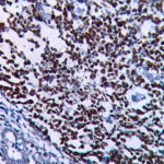 IHC on Tonsil Tissue