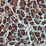 IHC on Appendicitis Tissue