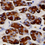 IHC on Pancreas Tissue
