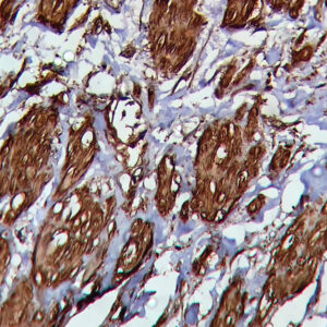 IHC on Abdomen Tissue