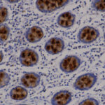 IHC on Colon Tissue