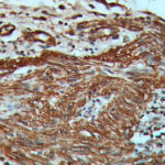 IHC on Colon Tissue