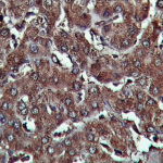 IHC on Liver Tissue