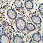 IHC on Colon Tissue