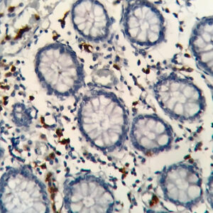 IHC on Colon Tissue