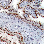 IHC on Prostate Tissue