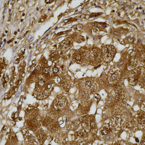 Anti-Serum Amyloid A