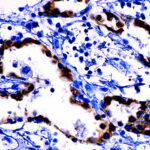 Anti-Progesterone-Receptor