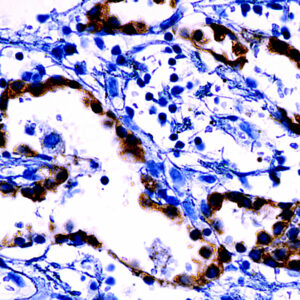 Anti-Progesterone-Receptor