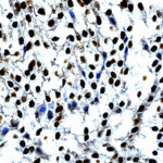 Steroidogenic Factor