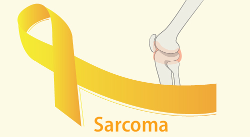 sarcoma