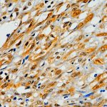 Mouse anti-human HSV 1 Monoclonal antibody